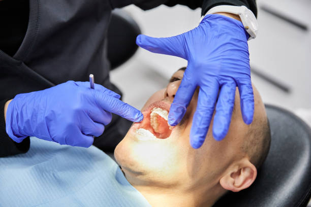 Best Emergency Tooth Extraction in Richmond, IL