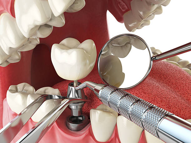 Best Emergency Dental Surgery in Richmond, IL