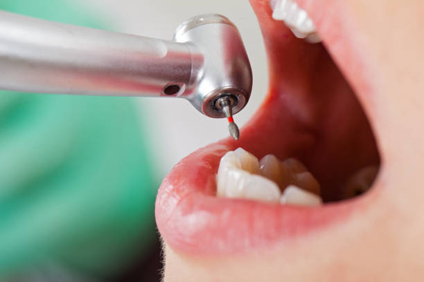Best Emergency Dental Care for Trauma or Injury in Richmond, IL